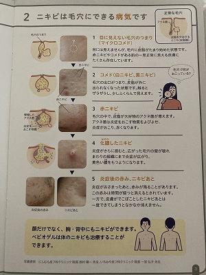 2ニキビは毛穴にできる病気