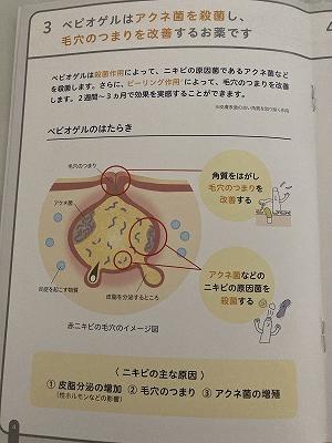 ３ベピオゲルは殺菌して毛穴のつまりを改善する