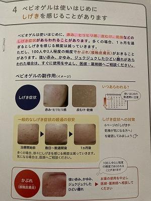 4使いはじめに刺激を感じることがある。